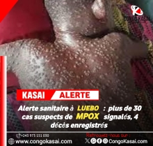 Kasai : Plus de 30 cas suspects de Mpox et 4 deces signales, alerte dans la zone de sante de Luebo